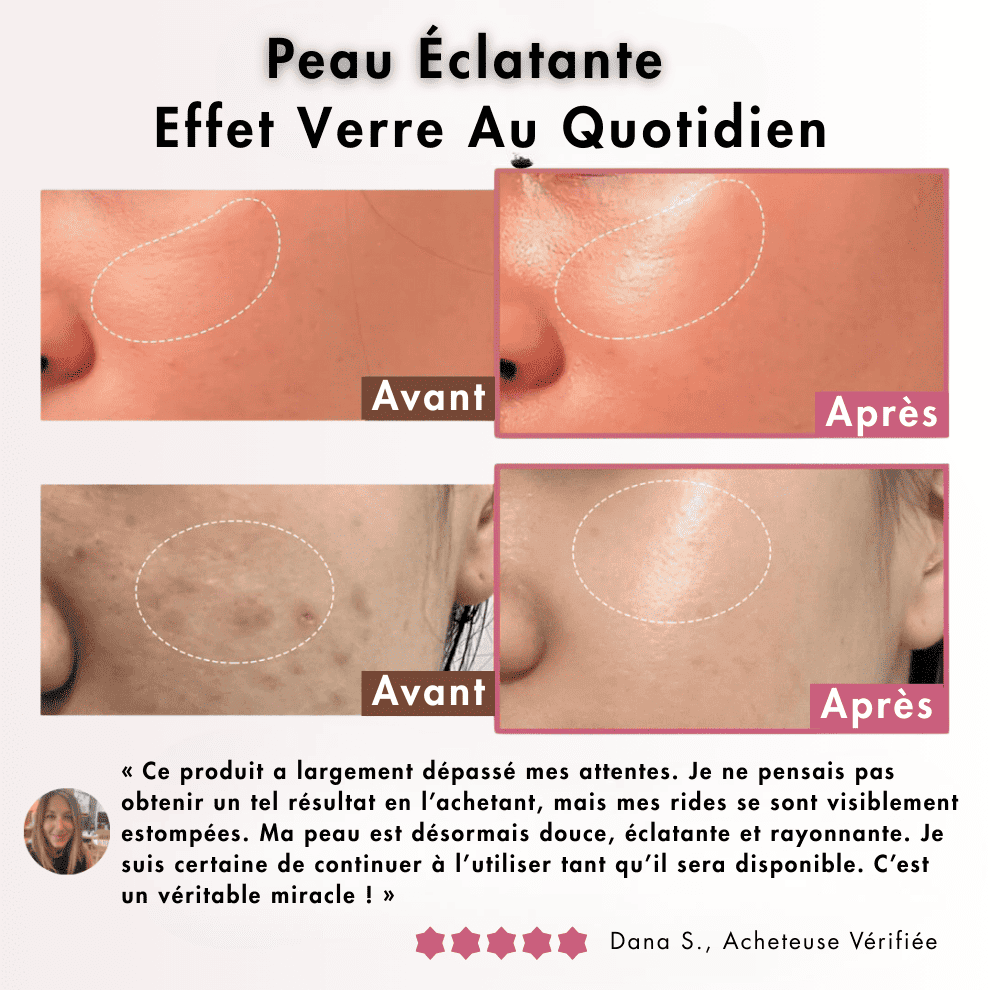 Aufemininshop™ – Crème Collagène Jelly Anti-Âge 100ml